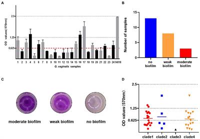 Biofilm and pathogenic factor analysis of Gardnerella vaginalis associated with bacterial vaginosis in Northeast China